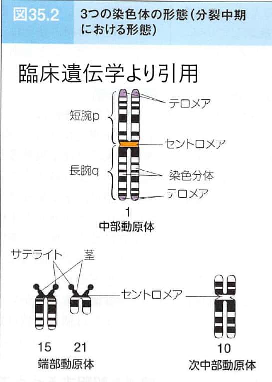 染色体検査法 G分染法 Gバンド 東京 ミネルバクリニック