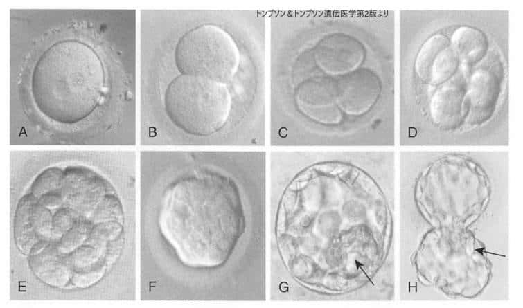 ヒトの胚発生