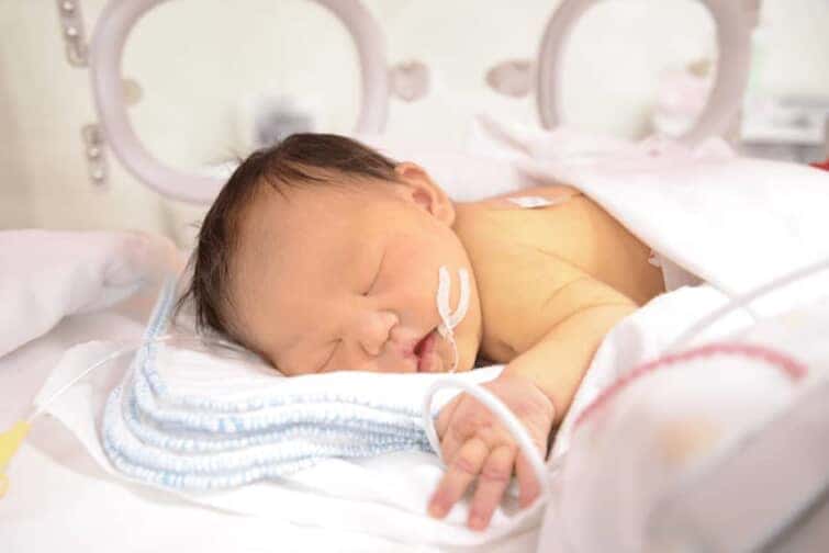 ダウン症の新生児の顔に現れる5つの特徴とは 診断と公的支援も紹介