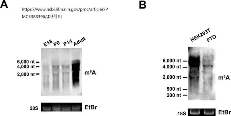 m6A特異的メチル化RNA免疫沈降法（MeRIP）