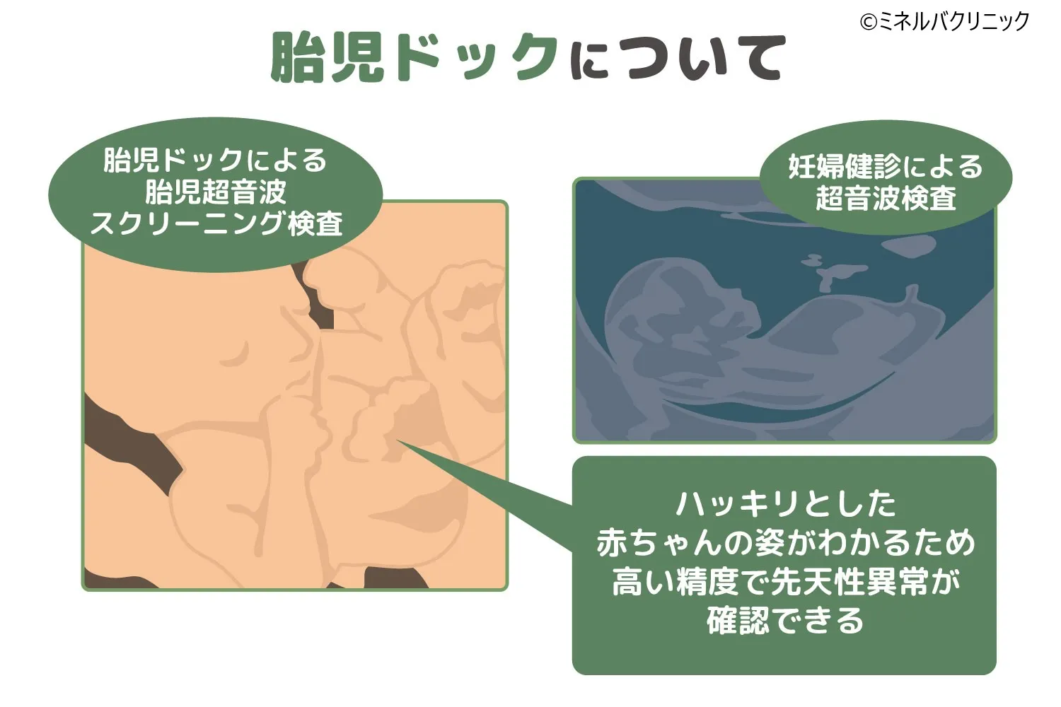 胎児ドック(胎児超音波スクリーニング検査)とは？検査でわかることを