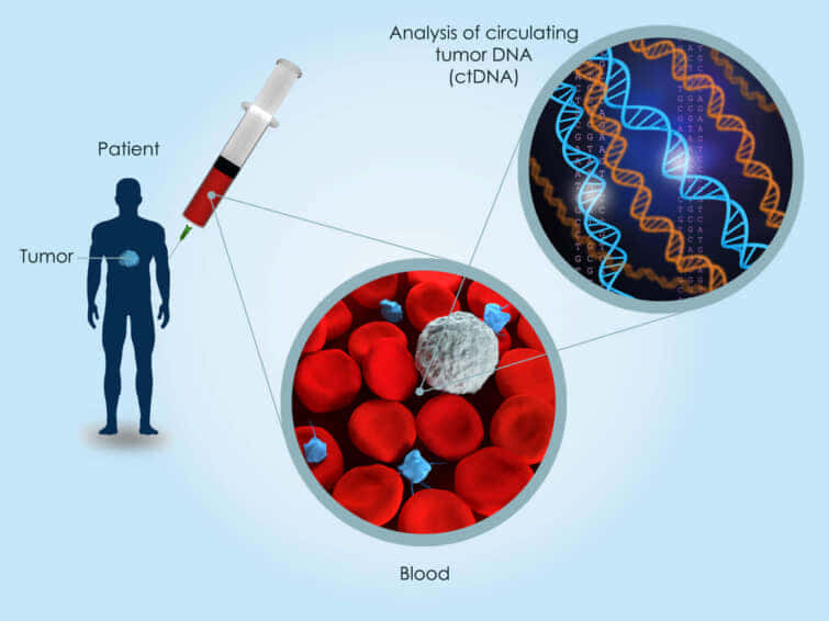 リキッドバイオプシー｜血液でがん検診・がんの再発チェック・効果のある抗がん剤がわかる