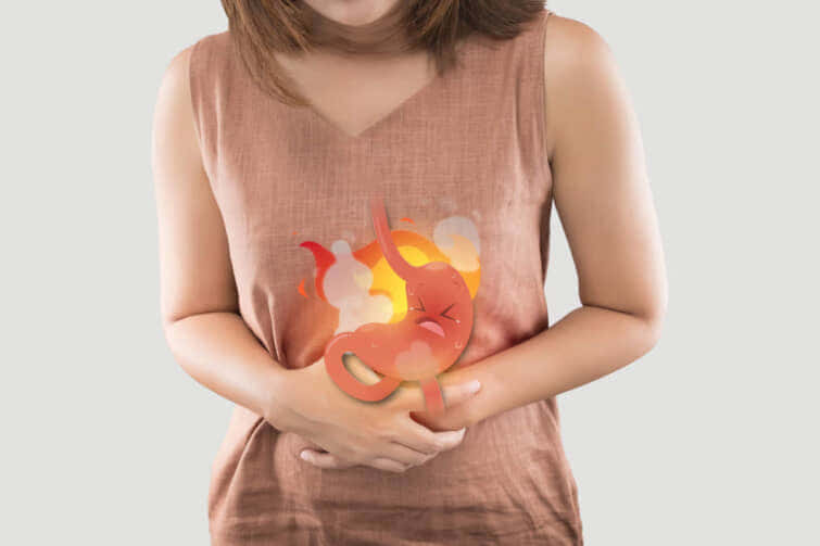 白い背景に女性の体にマンガの胃、酸逆流症の症状、胸焼け、医療と医療のコンセプト