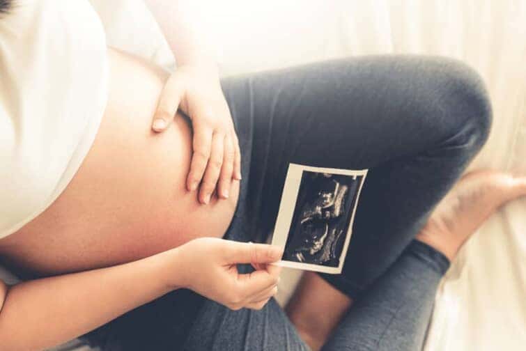 妊娠中の女性のおなかと赤ちゃんのエコー写真