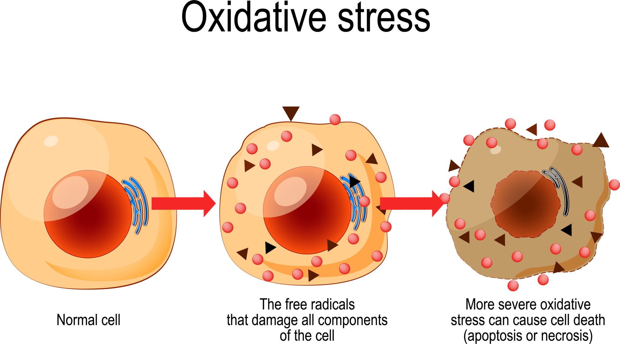 酸化ストレス