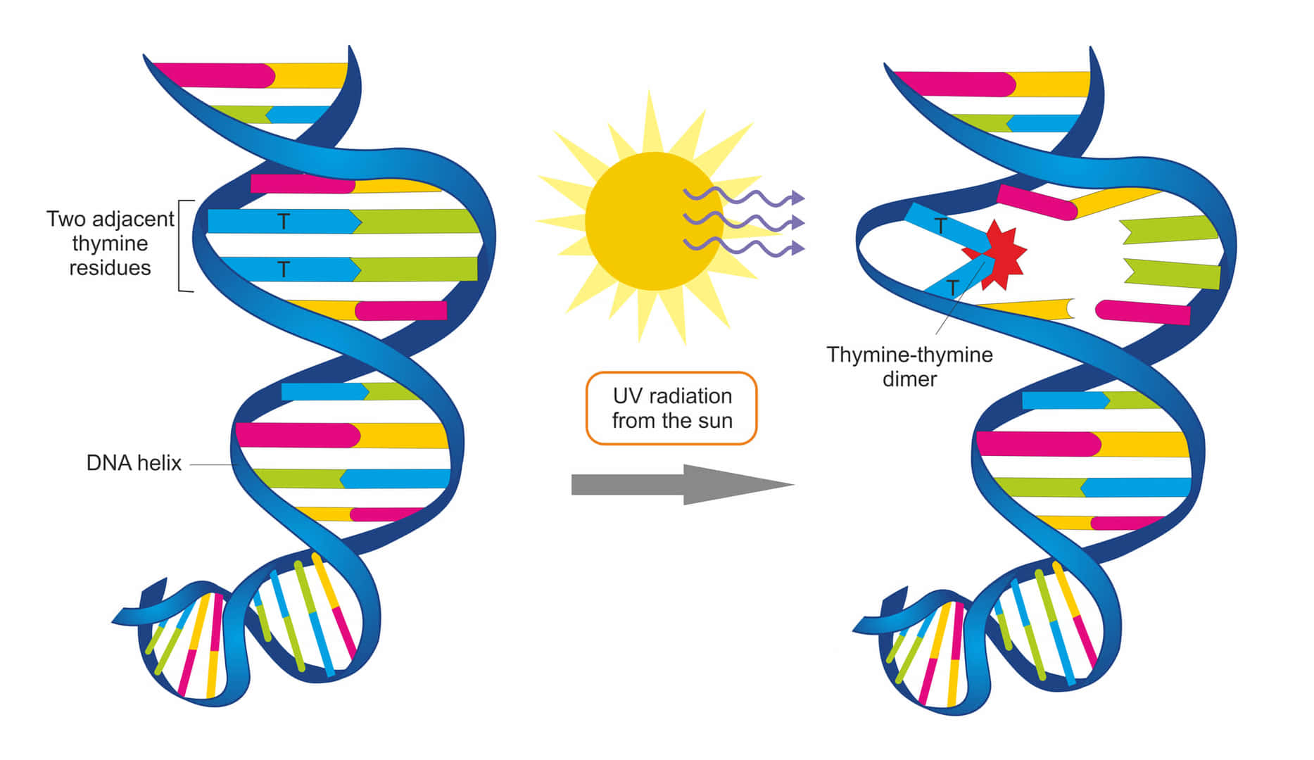 DNAのチミンジマーは、隣接する残渣が紫外線に曝されると生成される。ダイマーの蓄積は細胞死とがんを引き起こす。