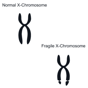 染色体のイメージ画像