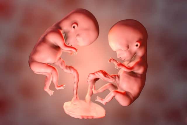 妊娠初期 双子を妊娠したかも 確定時期や体の変化 母体 胎児への影響まで解説