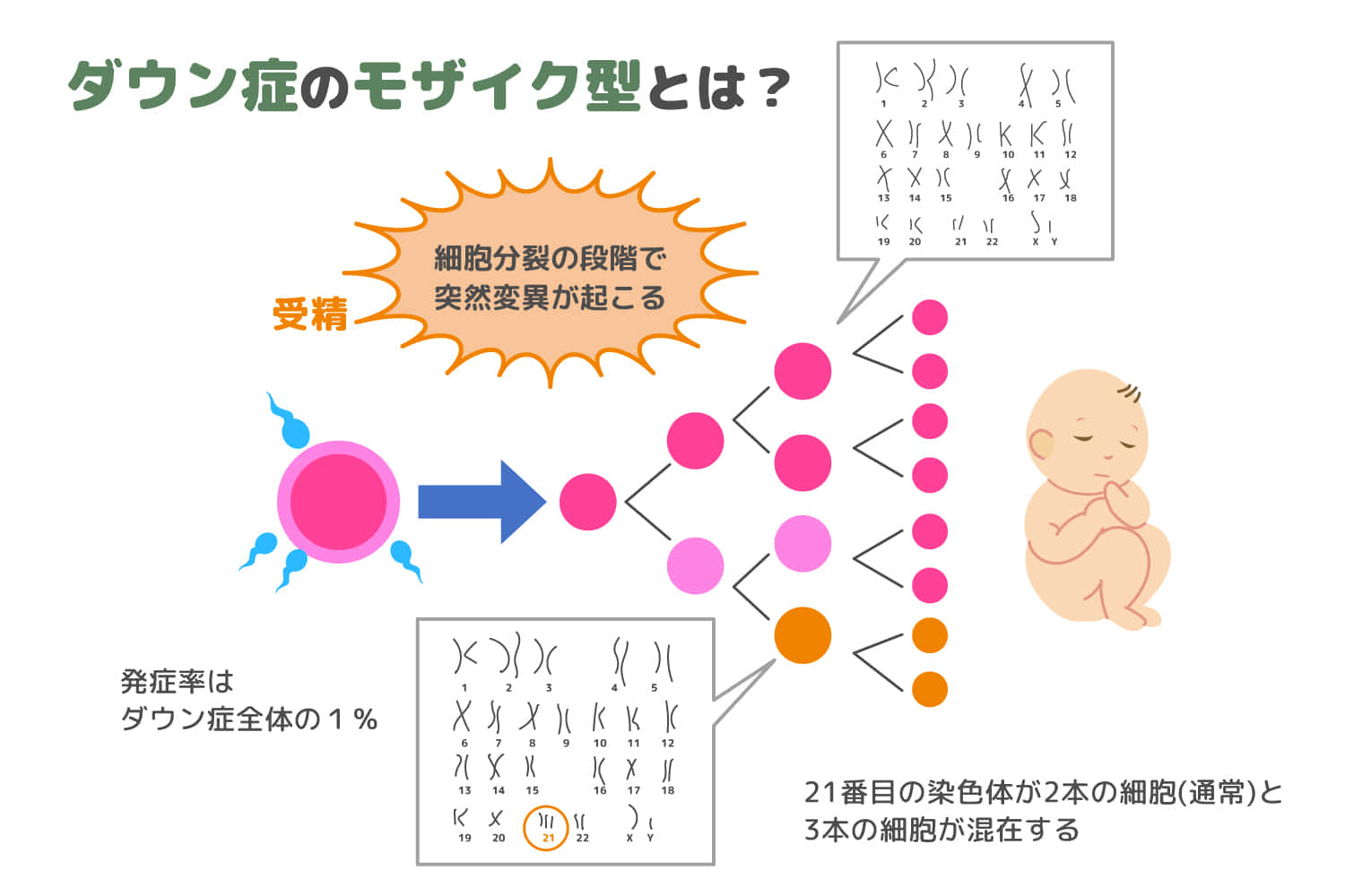 ダウン症のモザイク型とは？原因や症状について解説