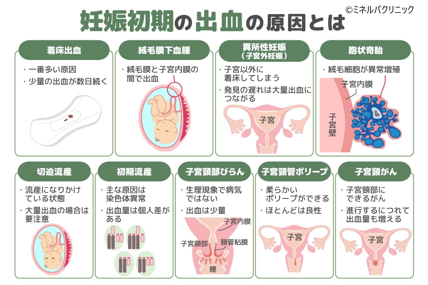 妊娠初期に起こりやすい不眠の原因と対策を紹介