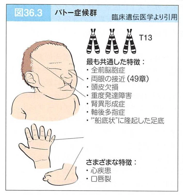 パトー症候群