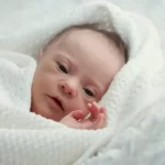 ダウン症候群の新生児の顔