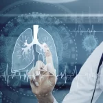 肺がん患者の術式を検討する医師のイメージ画像