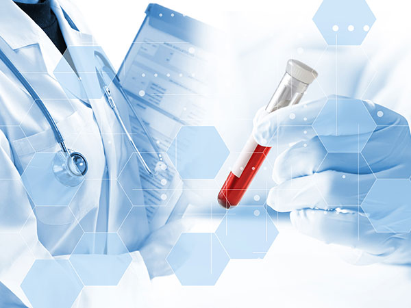 従来のNIPTとの違い