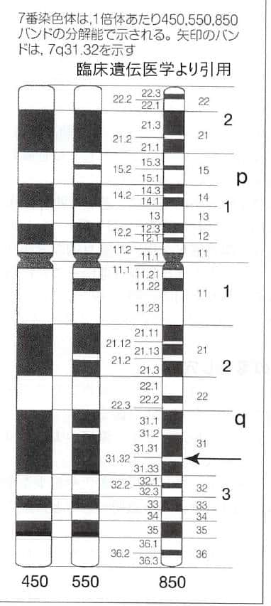 高精度分染法　７番染色体を１倍体450，550，850の分解能で見た模式図