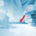 医師執筆 化学流産 生化学的妊娠 とは 妊娠判定薬で陽性だったのに妊娠していない