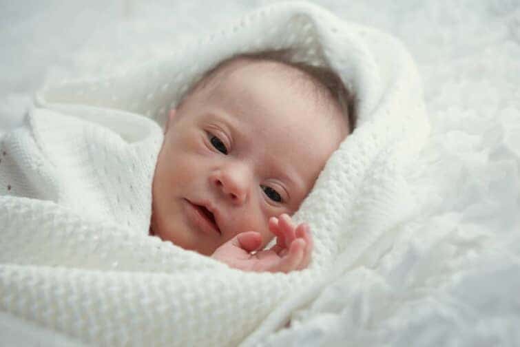 ダウン症新生児の目や耳など顔の特徴は 手や足などの身体的特徴も紹介