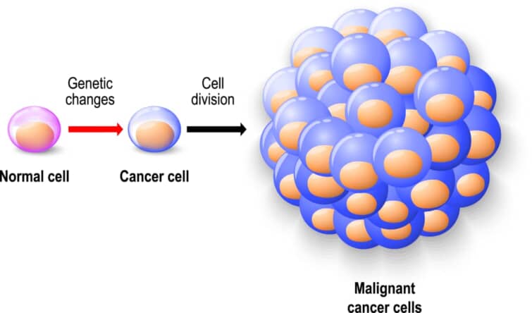 マイクロサテライト不安定性MSI-H/dMMRが関係するがん