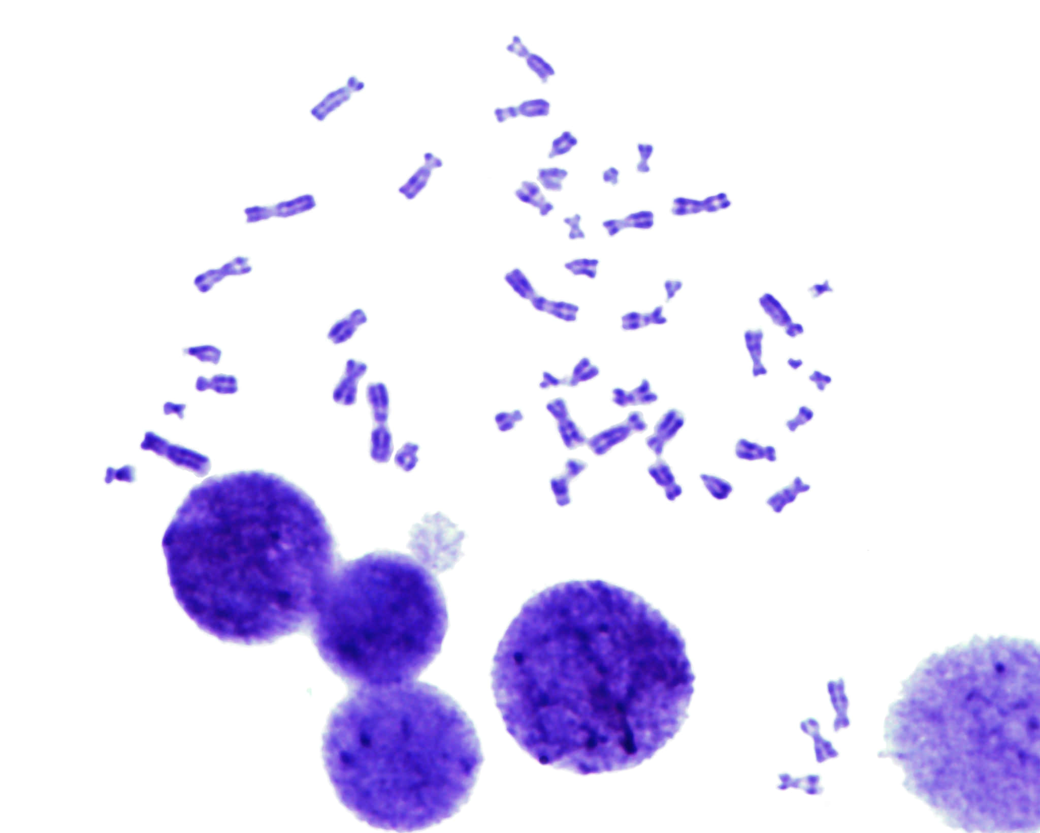 核型検査ギムザ染色Gバンド