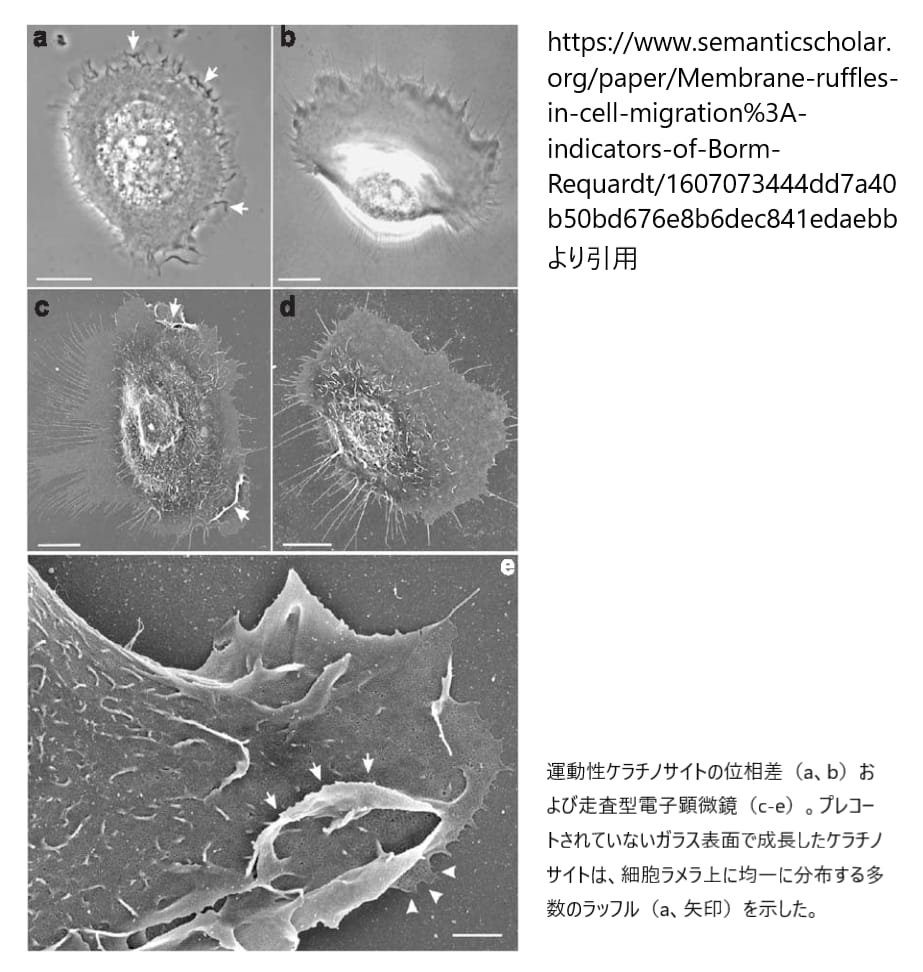 膜ラッフル