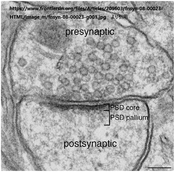 シナプス後肥厚