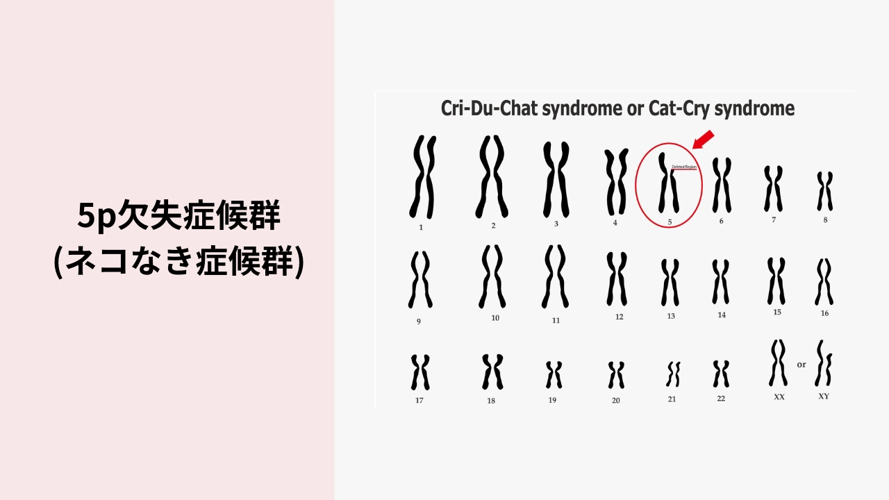 猫 鳴き 症候群