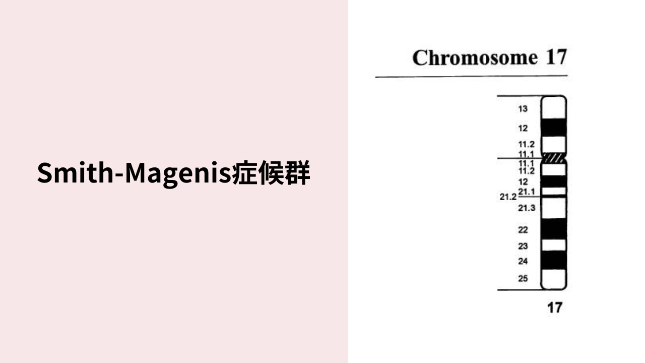 Smith-Magenis症候群 | 東京・ミネルバクリニック