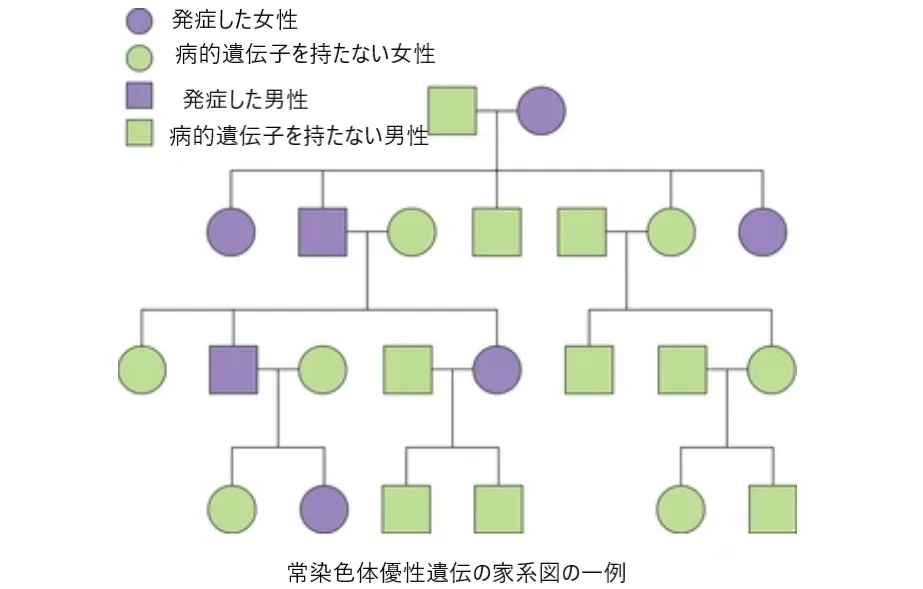 常染色体優性遺伝性疾患の家系図