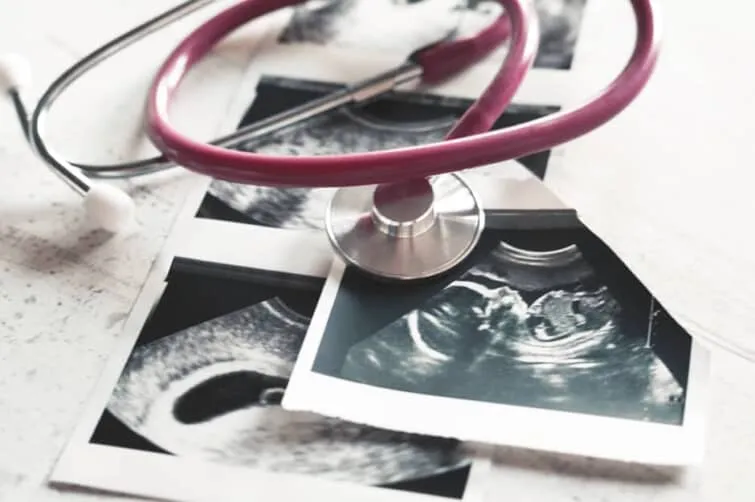 胎児の超音波写真と聴診器