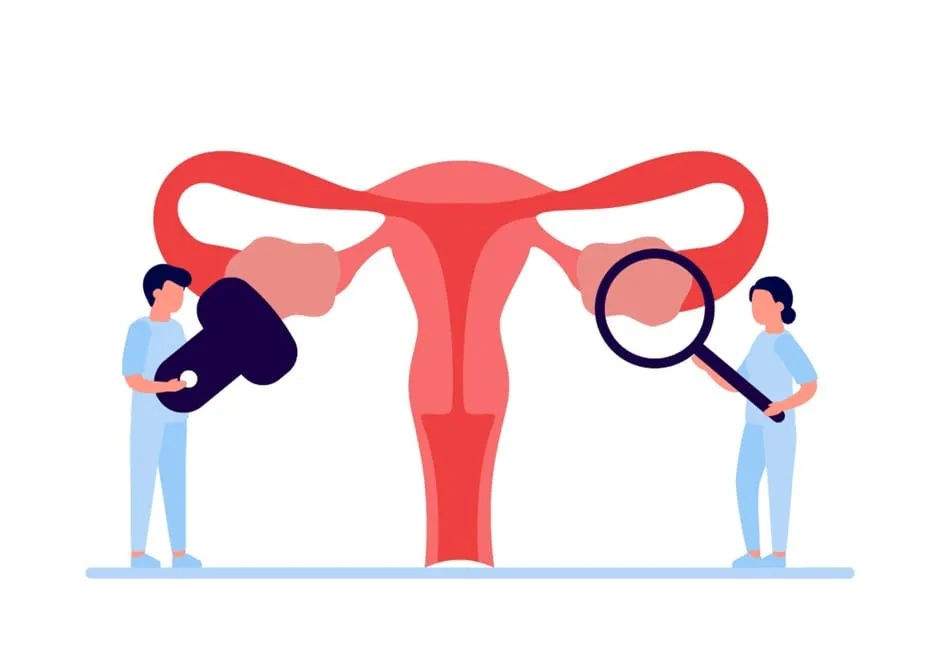 卵巣検査のイメージ画像