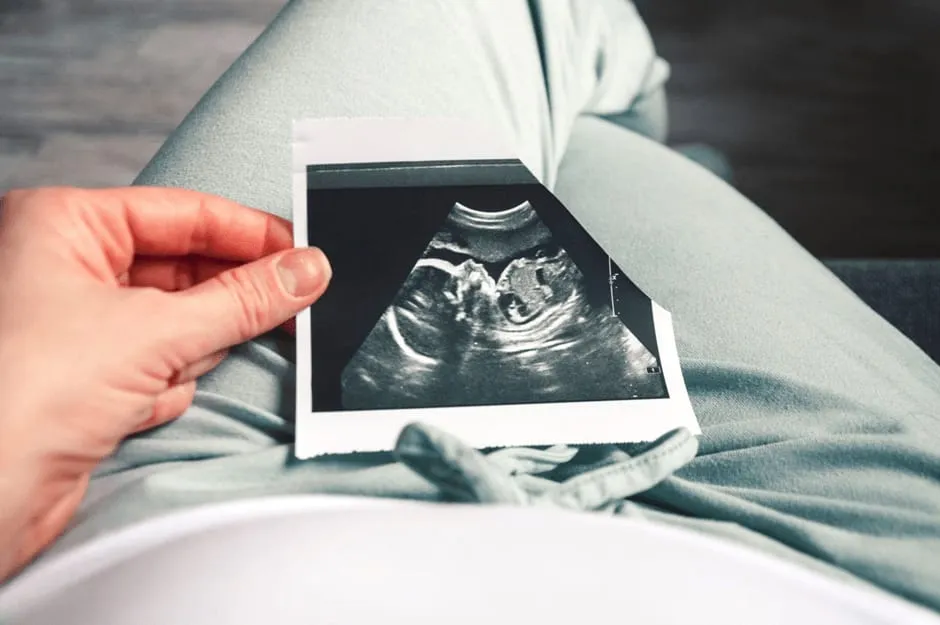 お腹の赤ちゃんが写っているエコー写真を見ている妊娠中期の女性