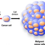 正常細胞ががんになって行く様子