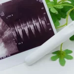 妊娠検査薬とエコーの図