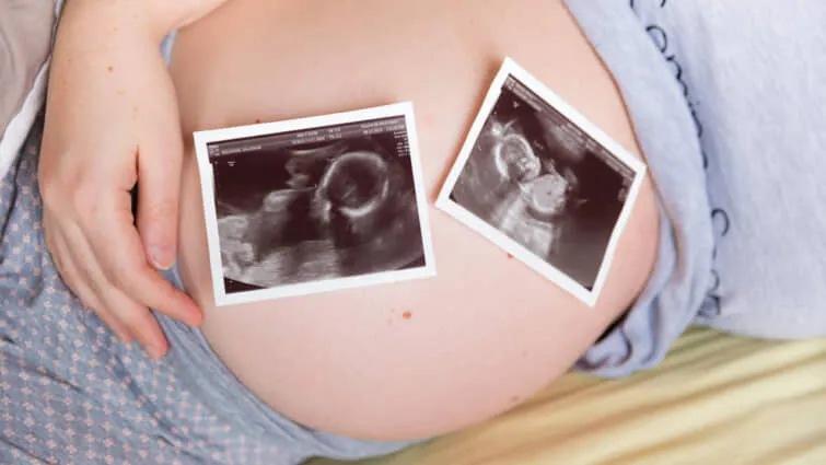 おなかに双子の2回の超音波スキャンを持つ妊婦