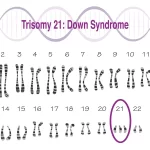 ダウン症候群の染色体イメージ画像