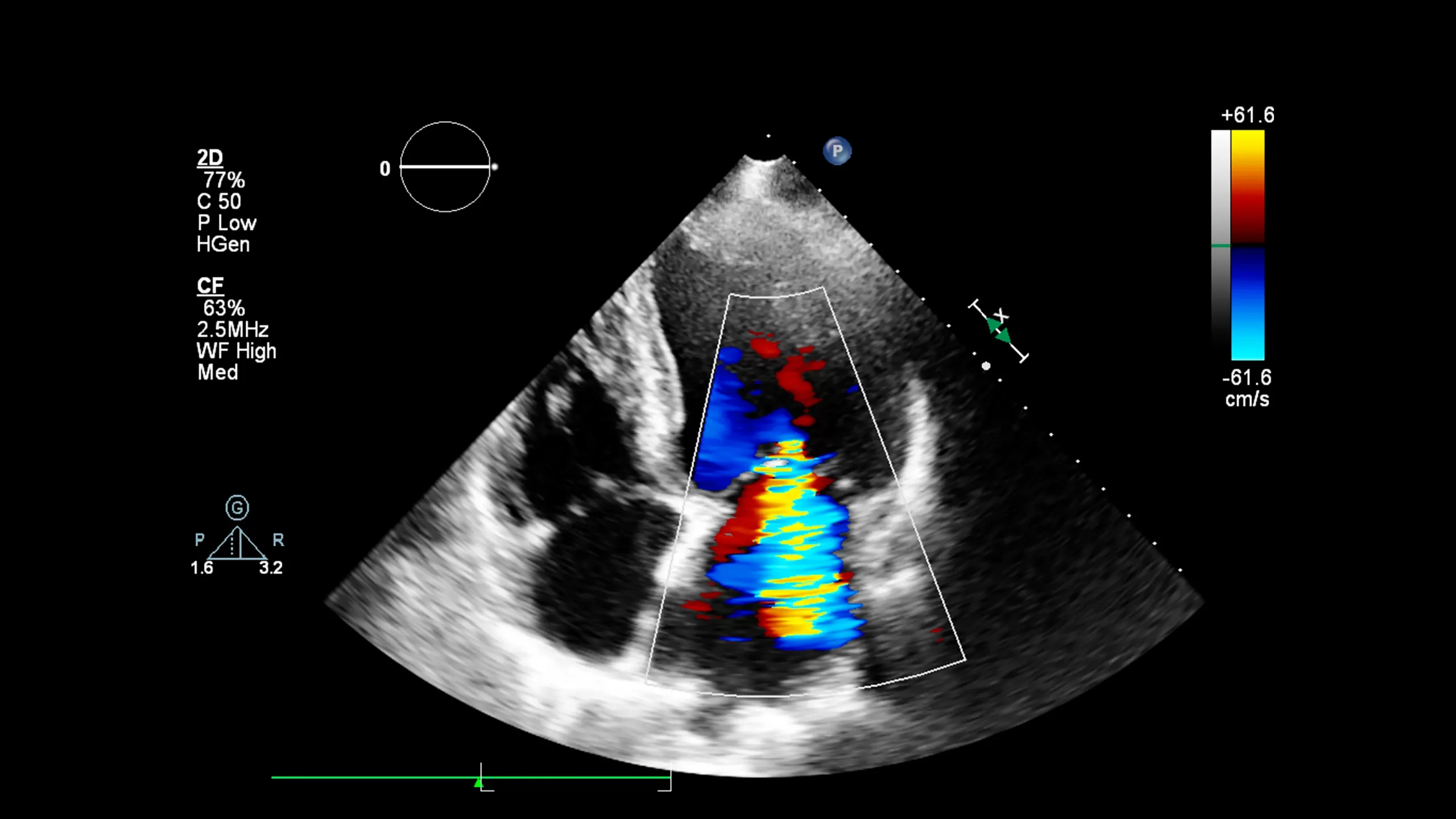 【専門医相談事例】全身性エリテマトーデスでステロイド治療中の妊娠｜安全性と注意点
