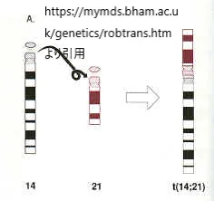 ロバートソン転座