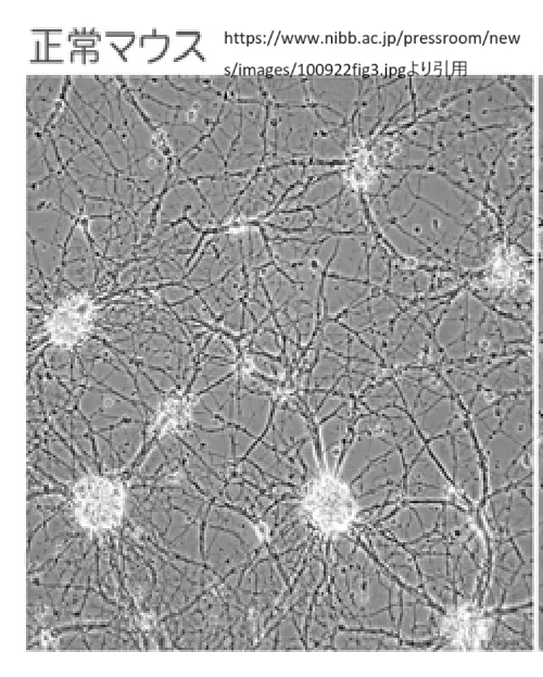 神経細胞ネットワーク
