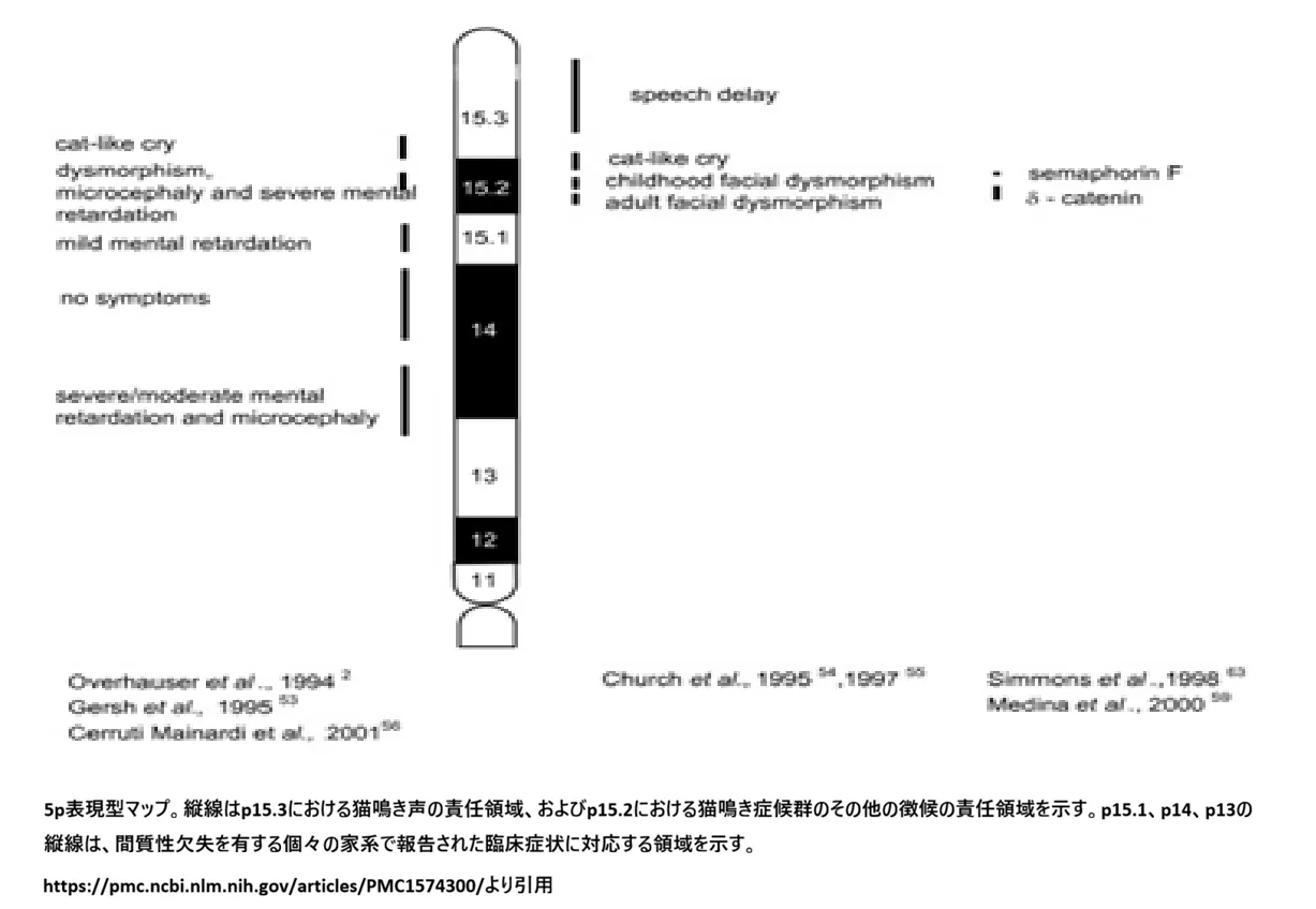 5番染色体短腕（5p）の表現型マップ。猫鳴き声の責任領域（p15.3）、その他の臨床徴候の責任領域（p15.2）、および間質性欠失による症状領域（p15.1・p14・p13）を示すイディオグラム