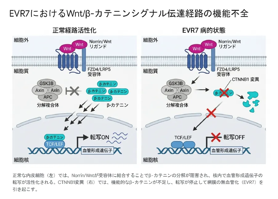 EVR7におけるWntβ-カテニンシグナル伝達経路の機能不全