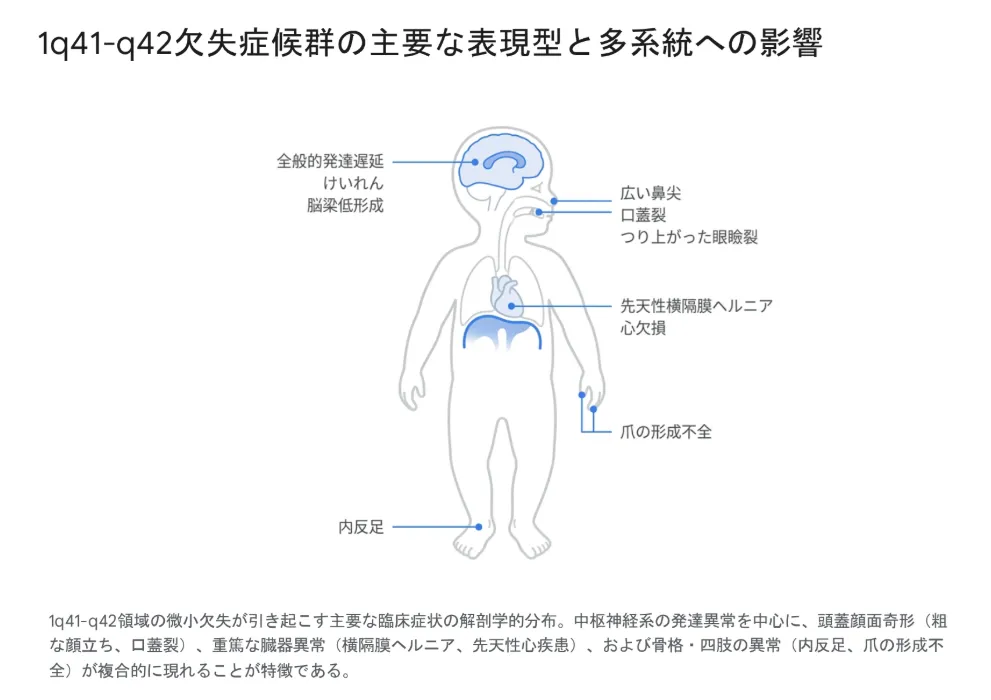 1q41－q42欠失症候群の主要な表現型と多系統への影響