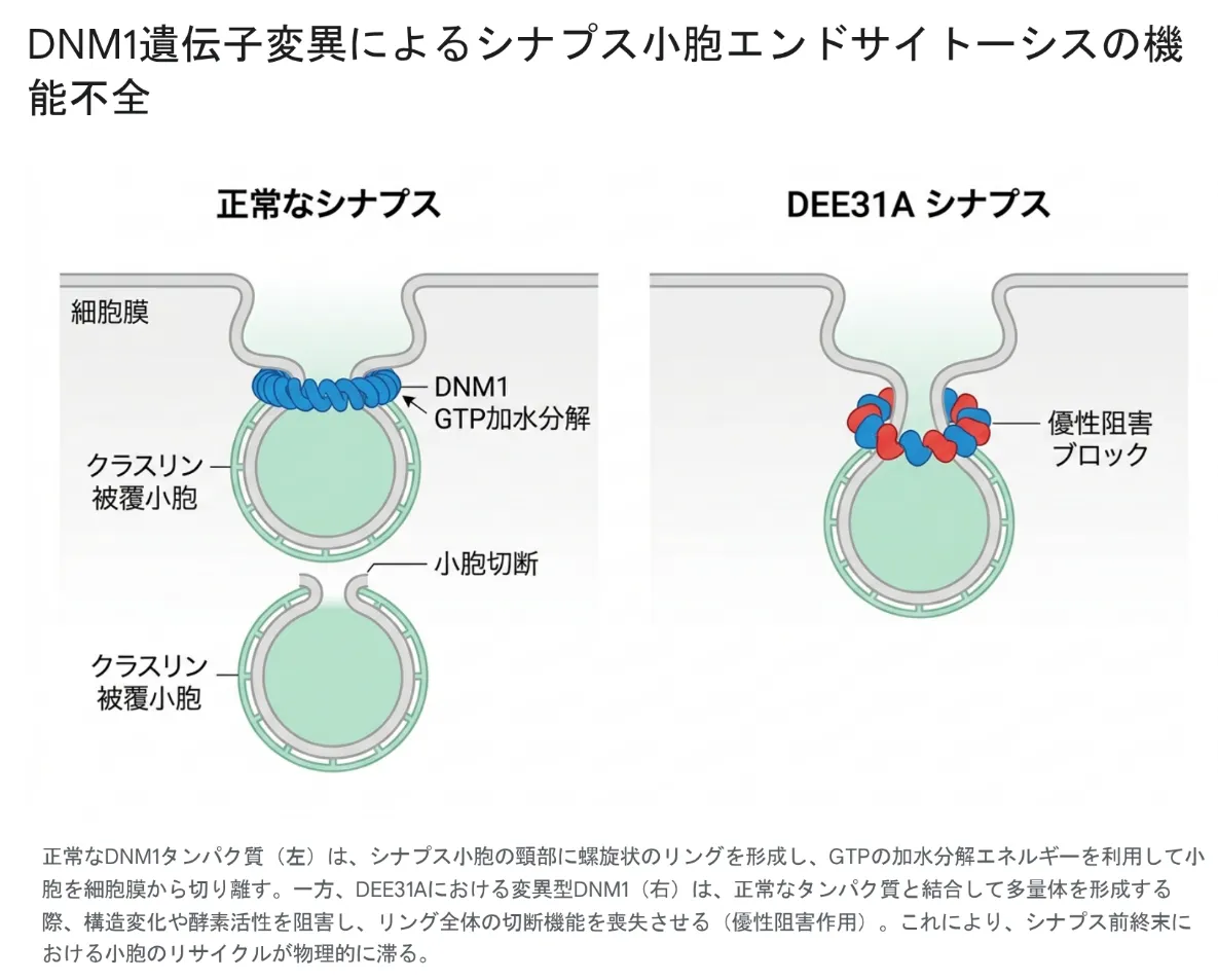 DNM1遺伝子変異によるシナプス小胞エンドサイトーシスの機能不全