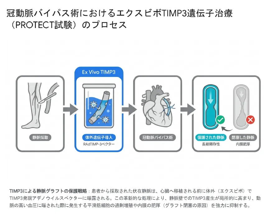 冠動脈バイパス術におけるエクスビボTIMP3遺伝子治療PROTECT試験のプロセス