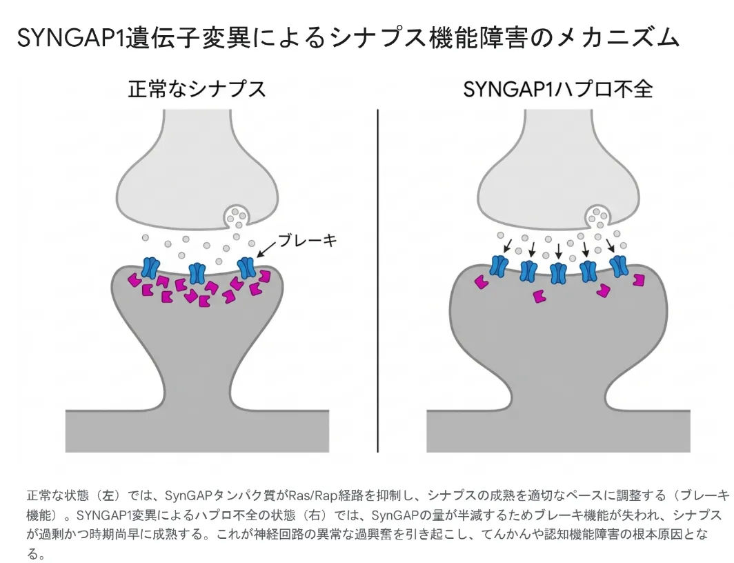 SYNGAP1遺伝子変異によるシナプス機能障害のメカニズムを示す図。左の正常なシナプスではSynGAPタンパク質（マゼンタ）がRas/Rap経路を抑制し、シナプスの成熟を適切なペースに調整する（ブレーキ機能）。右のSYNGAP1ハプロ不全ではSynGAPの量が半減してブレーキ機能が失われ、シナプスが過剰かつ時期尚早に成熟する様子を、正常時と対比して図解している。