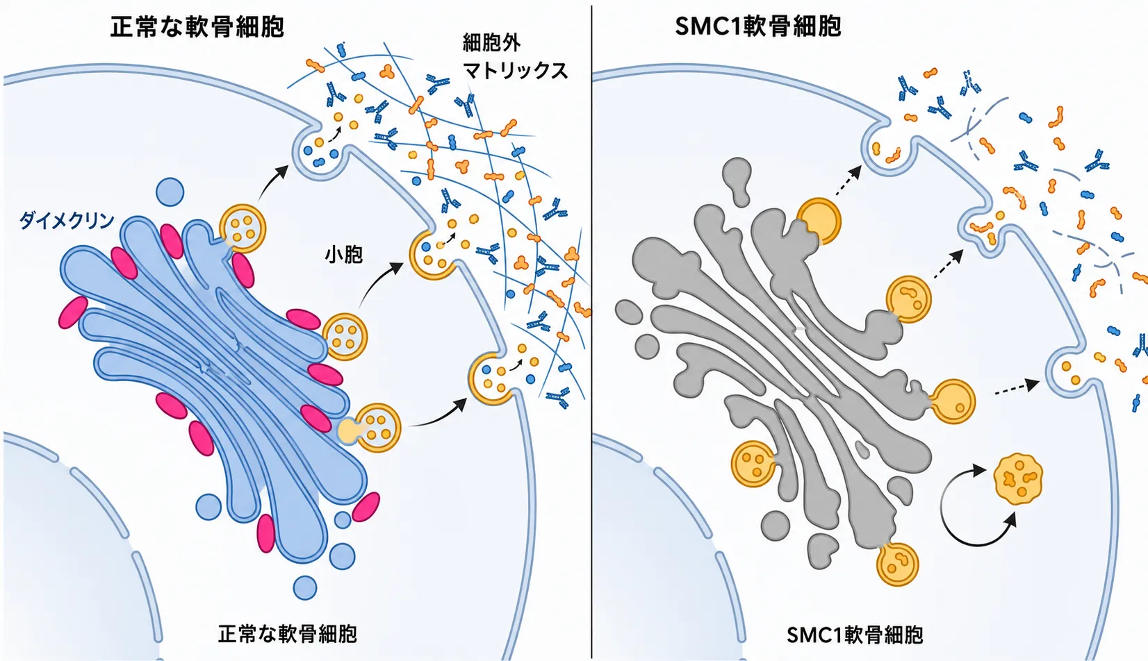 正常軟骨細胞とSmith-McCort異形成症1型(SMC1)軟骨細胞のゴルジ体機能を比較した模式図。左の正常細胞ではダイメクリンがゴルジ体に局在し、小胞輸送を介して細胞外マトリックス成分が分泌される。右のSMC1細胞ではダイメクリン機能の低下によりゴルジ体の構造と小胞輸送が乱れ、細胞外マトリックス形成が障害される様子を示す。