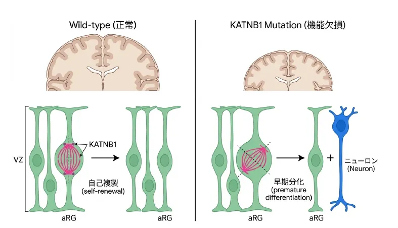KATNB1機能欠損による神経幹細胞の紡錘体配向異常と自己複製低下、早期分化によるニューロン産生と小頭症の発症機序