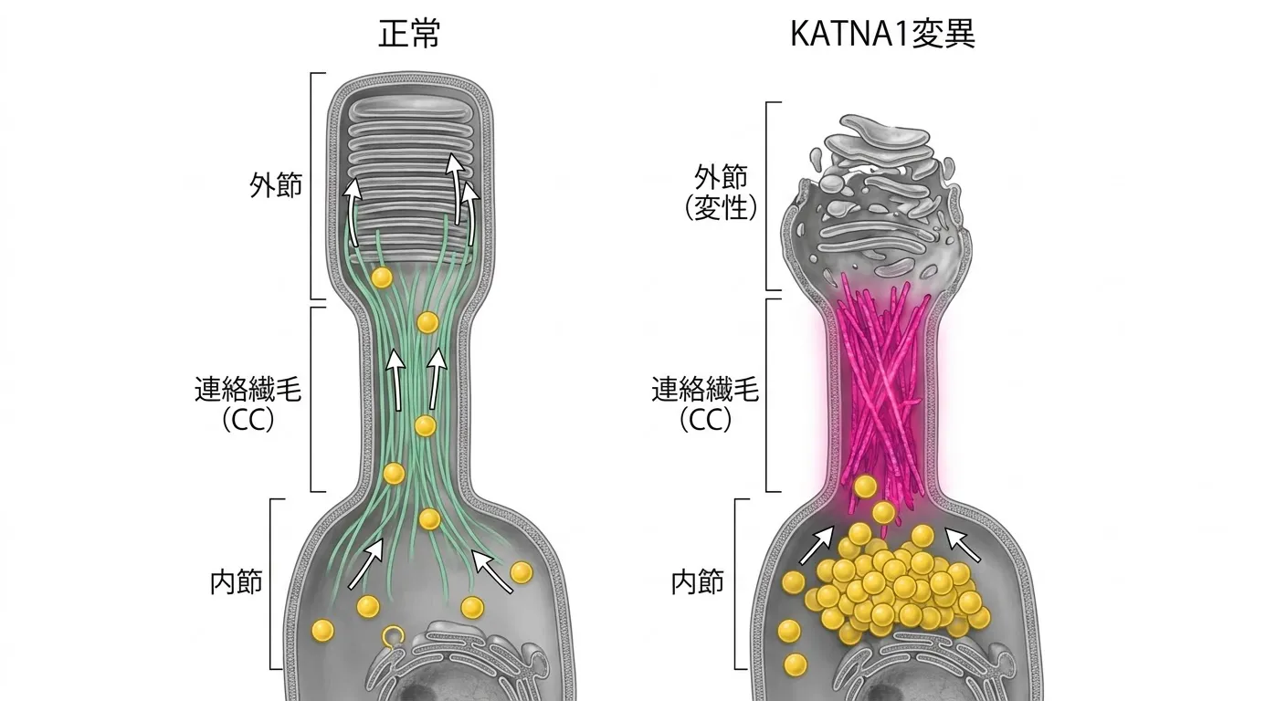 正常とKATNA1変異における視細胞・連絡繊毛の比較