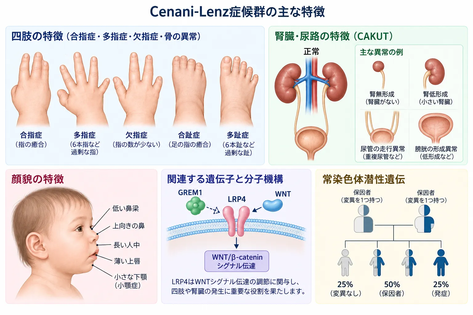 Cenani-Lenz症候群の四肢形成異常、腎・尿路異常（CAKUT）、顔貌の特徴、LRP4とWNT/β-cateninシグナル、常染色体潜性遺伝を示す医学イラスト