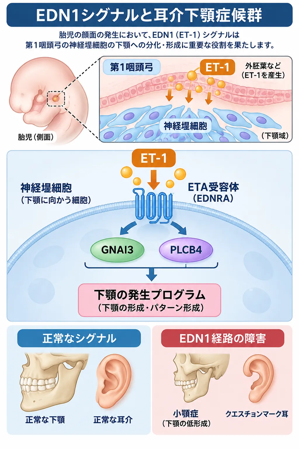 EDN1（ET-1）が第1咽頭弓の神経堤細胞にあるETA受容体（EDNRA）を介してGNAI3・PLCB4シグナルを伝え、下顎の正常な発生を促す仕組みと、EDN1経路の障害によって小顎症やクエスチョンマーク耳を特徴とする耳介下顎症候群につながる発症機序を示す模式図
