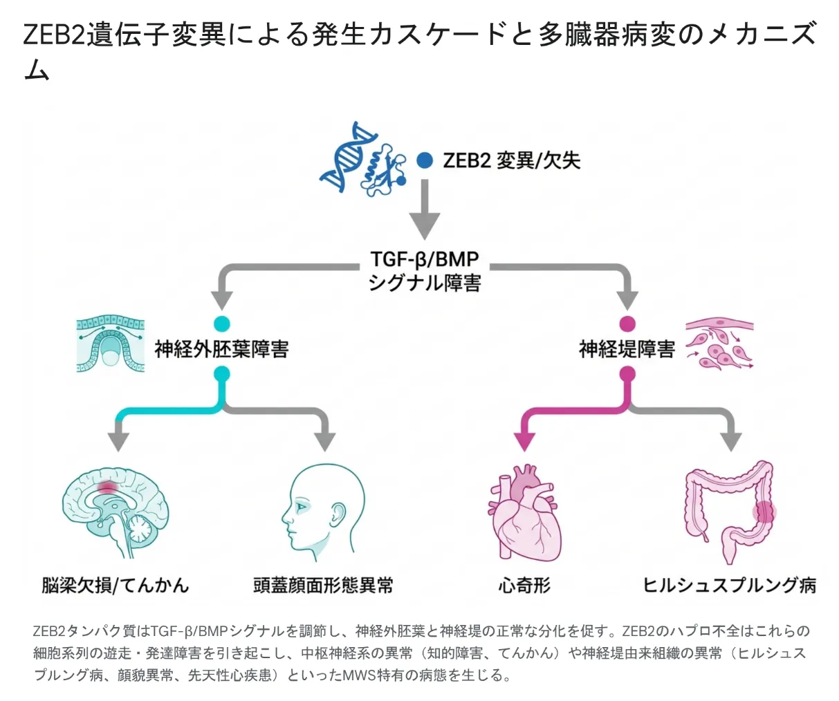 ZEB2遺伝子変異による多臓器病変の発生機序を上から下へ示すフローチャート。最上段の「ZEB2変異/欠失」から下向き矢印で「TGF-β/BMPシグナル障害」へ進む模式図として示され、そこで左右2経路に分岐する。左の「神経外胚葉障害」はさらに「脳梁欠損/てんかん(脳)」と「頭蓋顔面形態異常(顔)」に分かれる。右の「神経堤障害」は「心奇形(心臓)」と「ヒルシュスプルング病(腸)」に分かれる。ZEB2のハプロ不全がこれら細胞系列の分化・遊走や転写制御の異常を通じてMWSの多臓器病変に関与することを模式的に表す。